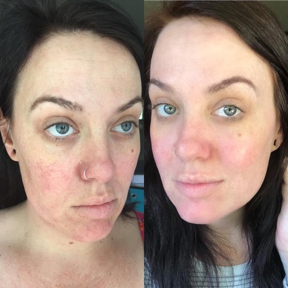 🌿BRAND NEW LUXURY SKINCARE🌿 - Picture 3 of 4